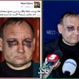 الصورة ليست لأسير من قوات النظام وإنما لعامل في أوكرانيا